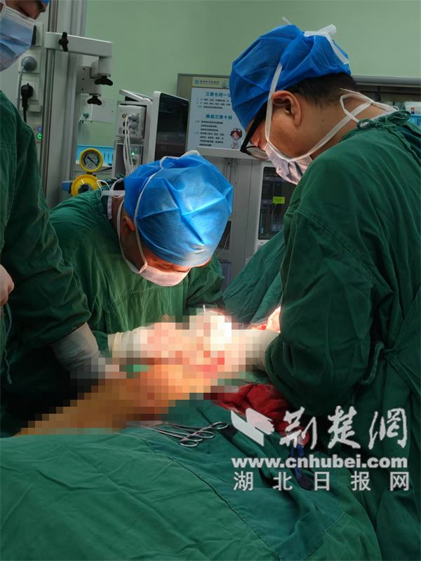 医生使用“炸弹处置”技能来保护60岁的生活渠道