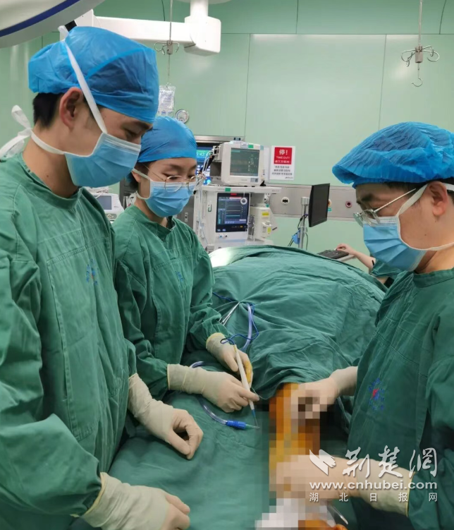 接收所有“直播”！微观士兵创造植入奇迹